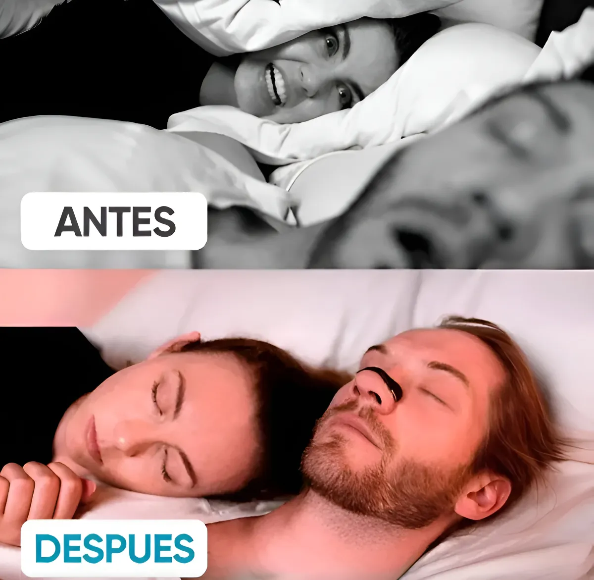 Kit dilatador respiratorio nasal - Anti-ronquido.